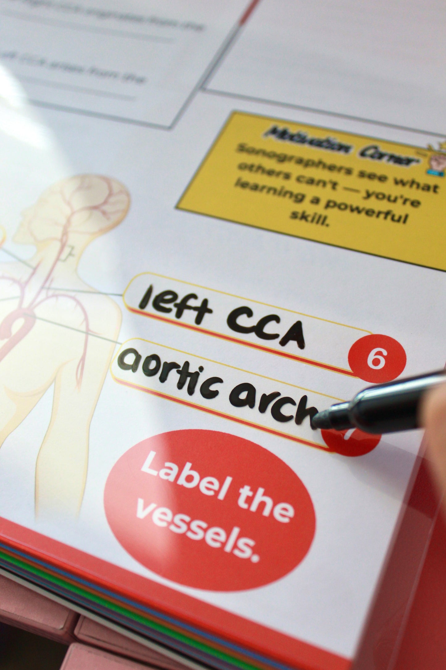 Sono Study Buddy Physical Book: Vascular Edition